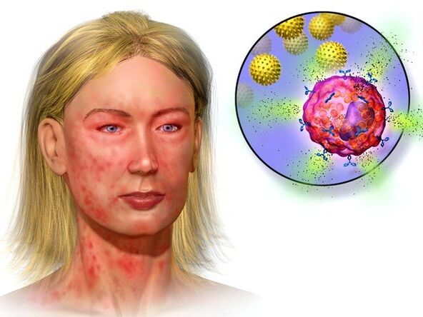 Echinokokken und Symptome ihrer Anwesenheit im Körper.